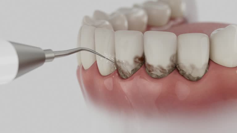 Reliable Emergency Dentist contractor in Milton, WI by Smile Center Dentistry